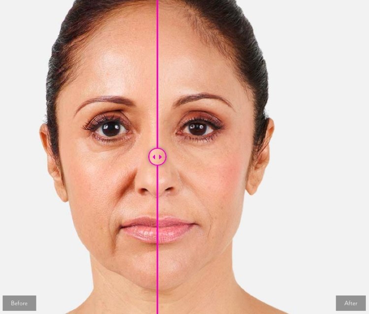 Beautiful Image of a rectangle