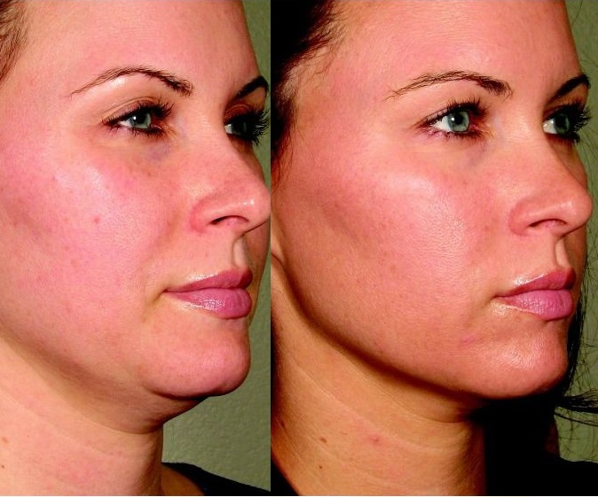 Beautiful Image of a rectangle