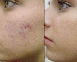 Beautiful Image of a rectangle